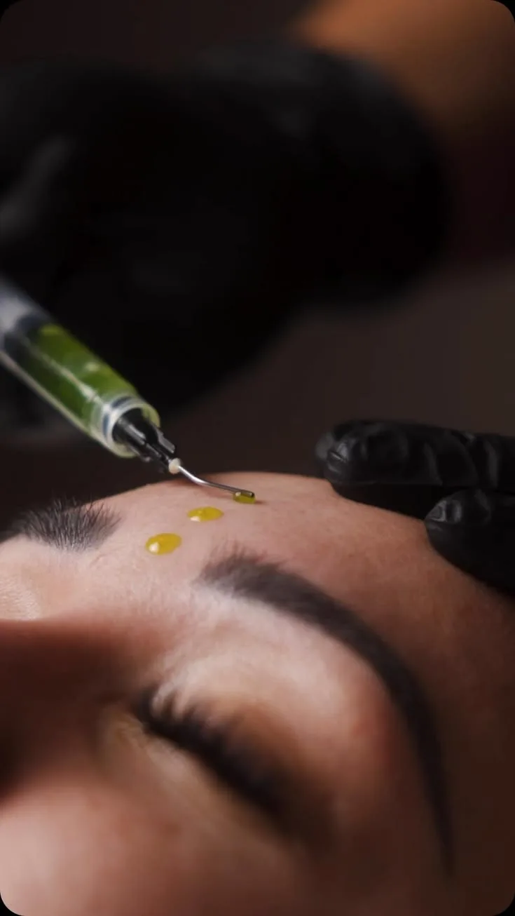 Biostimulation du Collagène Natinuel
