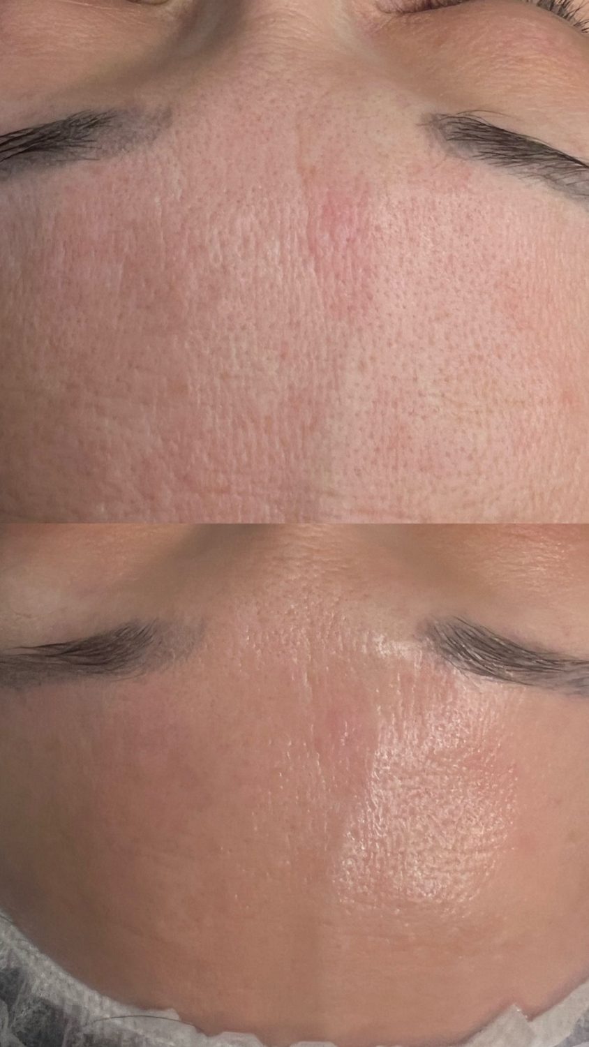 Avant apr&egrave;s effet glass skin &mdash; peau lisse et lumineuse, skin longevity