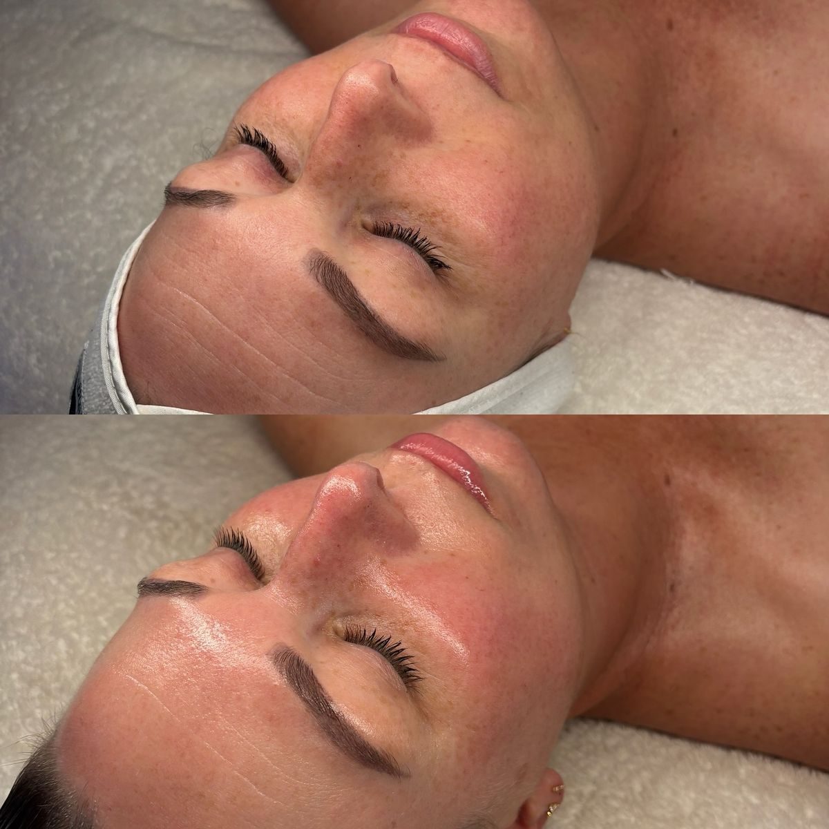 Avant après soin Glass Skin — éclat et teint unifié, Neuilly-sur-Seine & Paris