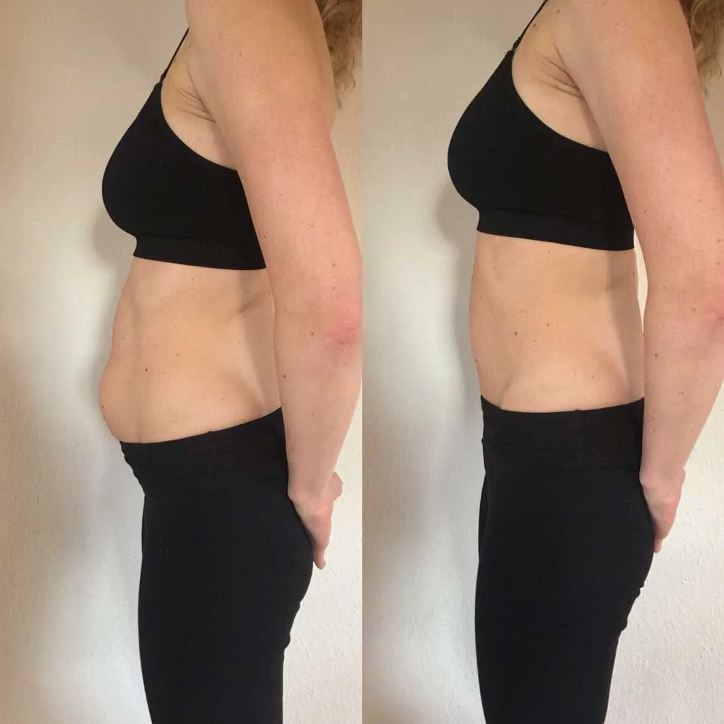Résultat avant / après — silhouette, ventre raffermi, Studio Anaj Neuilly-sur-Seine & Paris